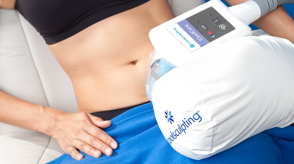 coolsculpting Vancouver