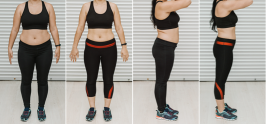 Coolsculpting Vancouver example